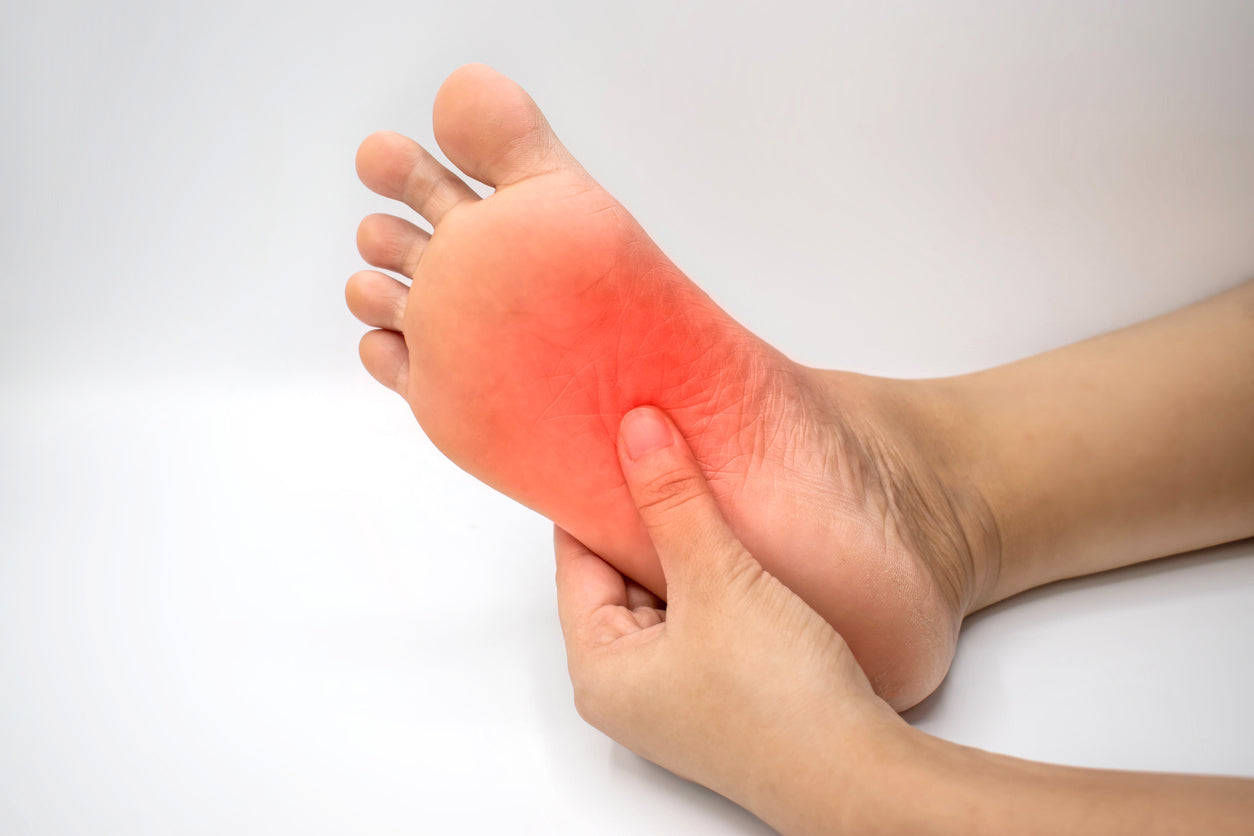 a foot with inflammation at the sole
